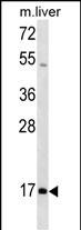 WB - HOXA1 Antibody (N-term) AP18470a