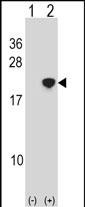 WB - NANOS2 Antibody (Center) AP18474c