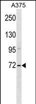 ZSWIM2 Antibody (C-term) (Cat. #AP18497b) western blot analysis in A375 cell line lysates (35ug/lane).This demonstrates the ZSWIM2 antibody detected the ZSWIM2 protein (arrow).