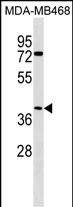 WB - ABHD1 Antibody (C-term) AP18498b