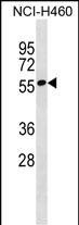 WB - ZNF302 Antibody (N-term) AP18510a