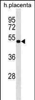 WB - LHX8 Antibody (Center) AP18525c