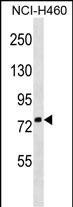 WB - ZNF607 Antibody (Center) AP18530C