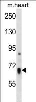 WB - HBS1L Antibody (Center) AP18556C