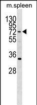 WB - HIC2 Antibody (Center) AP18558c