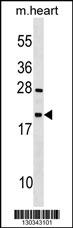 WB - TEX12 Antibody (Center) AP18566c