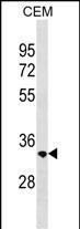WB - RAB40C Antibody (Center) AP18572c