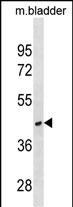 WB - RAB40C Antibody (Center) AP18572c