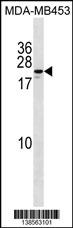 WB - ZNF580 Antibody (Center) AP18592c