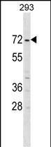 WB - ZNF643 Antibody (Center) AP18593c