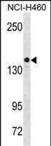 KIT Antibody (S746) (Cat. #AP18614c) western blot analysis in NCI-H460 cell line lysates (35ug/lane).This demonstrates the KIT antibody detected the KIT protein (arrow).