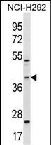 WB - GIPC2 Antibody (C-term) AP18639b