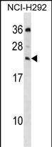 WB - MED19 Antibody (C-term) AP18645b