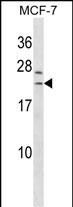 WB - SAP30L Antibody (Center) AP18649c