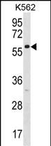 WB - ZNF212 Antibody (N-term) AP18653a
