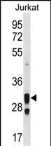 ACER1 Antibody (C-term) (Cat. #AP18654b) western blot analysis in Jurkat cell line lysates (35ug/lane).This demonstrates the ACER1 antibody detected the ACER1 protein (arrow).