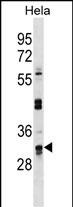 WB - UTP11L Antibody (C-term) AP18665b