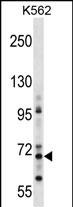 WB - ZNF256 Antibody (Center) AP18671c