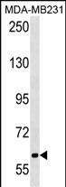 WB - TRPC4AP Antibody (N-term) AP18682a