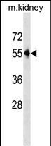 WB - Mouse Pnpla3 Antibody (C-term) AP18690b