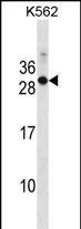 WB - Mouse Rab17 Antibody (Center) AP18691C
