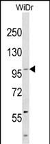 KIT Antibody (Center Y730) western blot analysis in WiDr cell line lysates (35ug/lane).This demonstrates the KIT antibody detected the KIT protein (arrow).