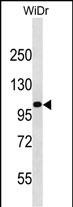 KIT Antibody (Center Y578) (Cat. #AP18712c) western blot analysis in WiDr cell line lysates (35ug/lane).This demonstrates the KIT antibody detected the KIT protein (arrow).