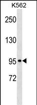 KIT Antibody (C-term S959)(Cat. #AP18723b) western blot analysis in K562 cell line lysates (35ug/lane).This demonstrates the KIT antibody detected the KIT protein (arrow).