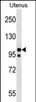 WB - NLRP4 Antibody (N-term) AP18739a