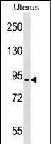 WB - ASTE1 Antibody (N-term) AP18741a