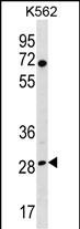 WB - RPA4 Antibody (C-term) AP18746b