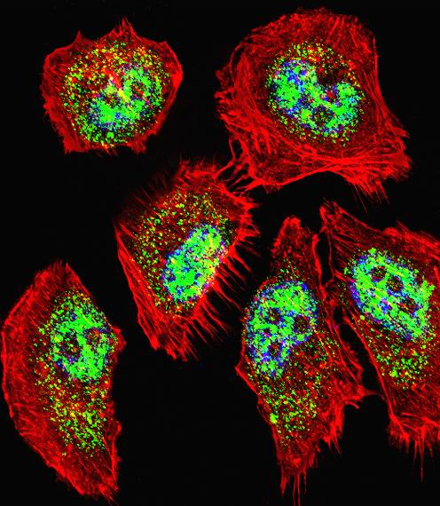 Fluorescent confocal image of A549 cell stained with ZHX2 Antibody (N-term)(Cat#AP18752a).A549 cells were fixed with 4% PFA (20 min), permeabilized with Triton X-100 (0.1%, 10 min), then incubated with ZHX2 primary antibody (1:25, 1 h at 37?). For secondary antibody, Alexa Fluor� 488 conjugated donkey anti-rabbit antibody (green) was used (1:400, 50 min at 37?).Cytoplasmic actin was counterstained with Alexa Fluor� 555 (red) conjugated Phalloidin (7units/ml, 1 h at 37?). Nuclei were counterstained with DAPI (blue) (10 �g/ml, 10 min). ZHX2 immunoreactivity is localized to Nucleus significantly and Cytoplasm weakly.