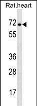 WB - Rat Stra6 Antibody (C-term) AP18757b