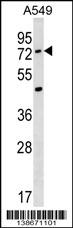 ACSM2A Antibody (N-term)(Cat. #AP18758a) western blot analysis in A549 cell line lysates (35ug/lane).This demonstrates the ACSM2A antibody detected the ACSM2A protein (arrow).