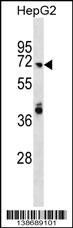 WB - ARHGAP40 Antibody (N-term) AP18764A