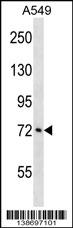 WB - ATXN1L Antibody (Center) AP18768C