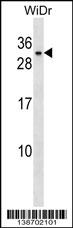 WB - BHLHA9 Antibody (Center) AP18770c
