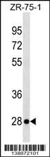 WB - KLRF2 Antibody (N-term) AP18787a