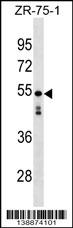WB - KT81L Antibody (N-term) AP18788a