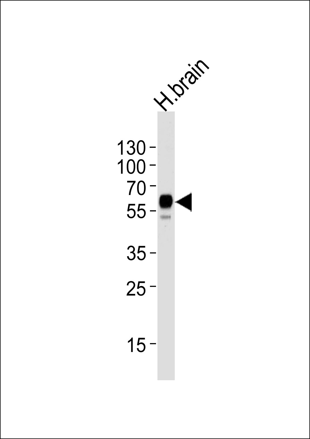 WB - LRRTM2 Antibody (C-term) AP18792b