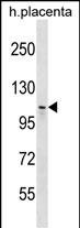WB - MMS19 Antibody (Center) AP18795c
