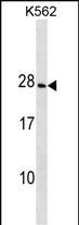 CRYGD Antibody (Center)(Cat. #AP18816c) western blot analysis in K562 cell line lysates (35ug/lane).This demonstrates the CRYGD antibody detected the CRYGD protein (arrow).