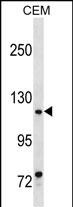 WB - MKL1 Antibody (Center) AP18838C