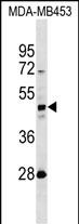 WB - KRT31 Antibody (N-term) AP18844A