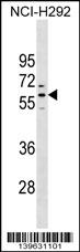 WB - PRAMEF1 Antibody (C-term) AP18861B