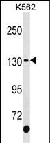 KIT Antibody (C-term Y900)(Cat. #AP18887b) western blot analysis in K562 cell line lysates (35ug/lane).This demonstrates the KIT antibody detected the KIT protein (arrow).