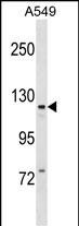 KIT Antibody (Center T354)(Cat. #AP18888c) western blot analysis in A549 cell line lysates (35ug/lane).This demonstrates the KIT antibody detected the KIT protein (arrow).