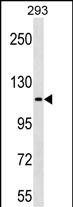KIT Antibody (C-term Y936)(Cat. #AP18889b) western blot analysis in 293 cell line lysates (35ug/lane).This demonstrates the KIT antibody detected the KIT protein (arrow).