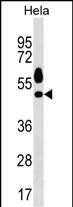 WB - Mouse Sgk1 Antibody (C-term) AP18909b
