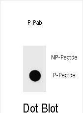 Dot blot analysis of Phospho-mouse BAD-S111 Antibody Phospho-specific Pab (Cat. #AP3777a) on nitrocellulose membrane. 50ng of Phospho-peptide or Non Phospho-peptide per dot were adsorbed. Antibody working concentrations are 0.6ug per ml.
